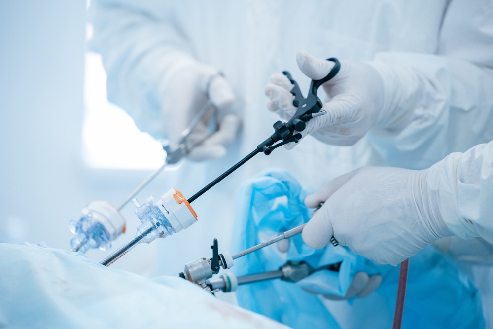 Close-up,Of,Surgeons,Performing,Laparoscopic,Surgery,With,Precision,Instruments,For