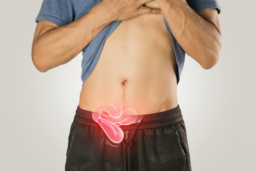 Illustration,Depicts,Hernia,Symptoms,In,A,Man,S,Body.,Common