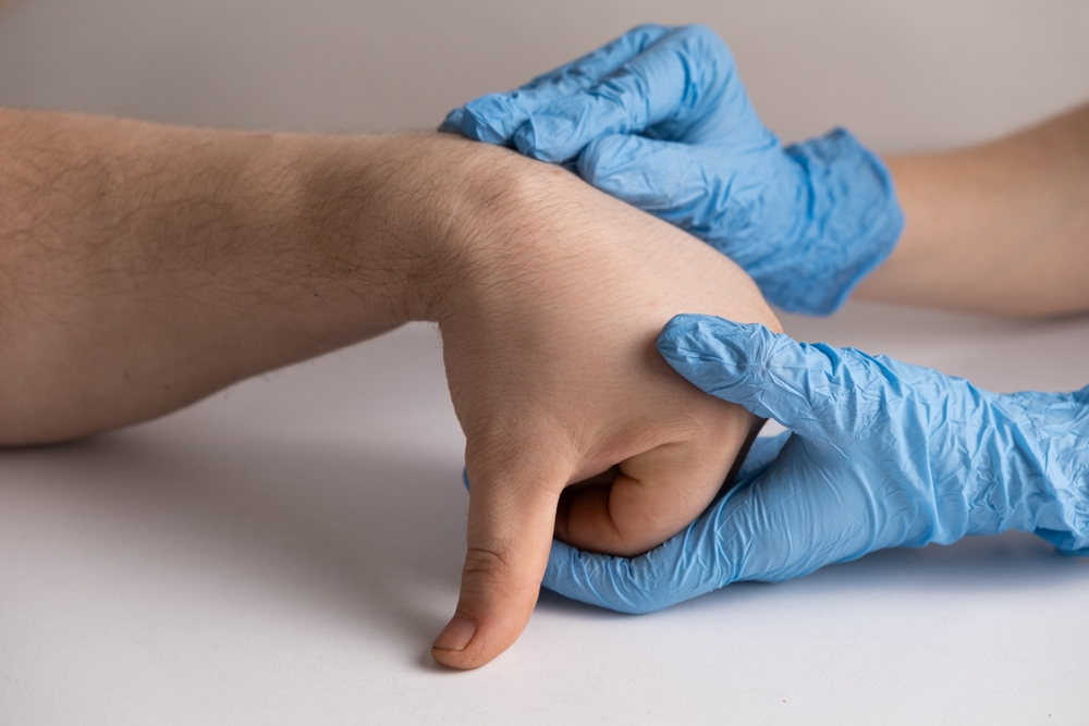 Ganglion,Cyst,Or,Hygroma,Of,The,Wrist,On,The,Hand