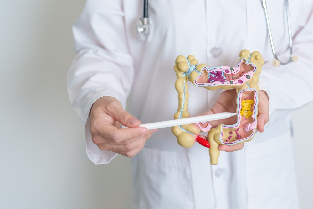 Doctor,Holding,Human,Colon,Anatomy,Model.,Colonic,Disease,,Large,Intestine,